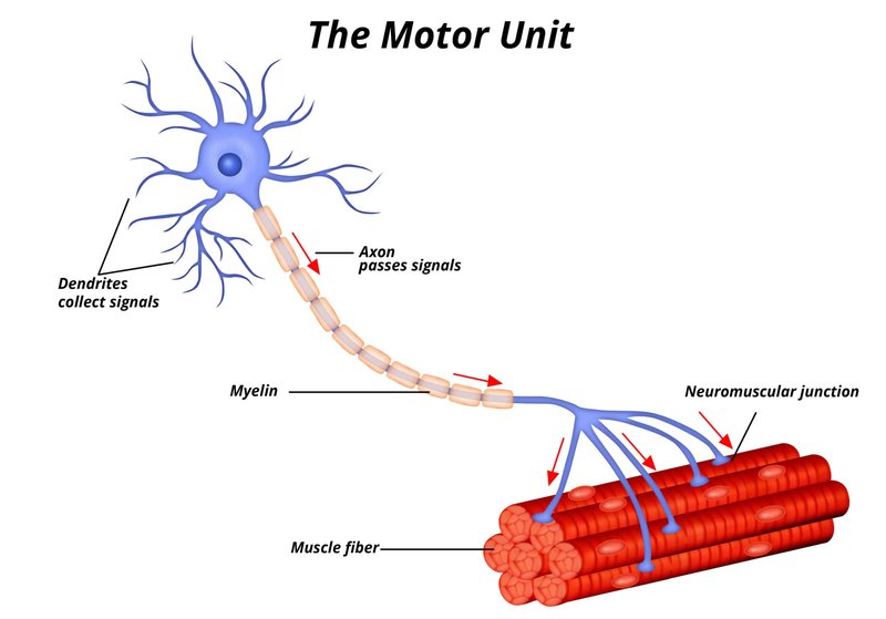 Beginner'S Guide To Quiet Motor Units